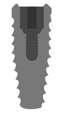 connection